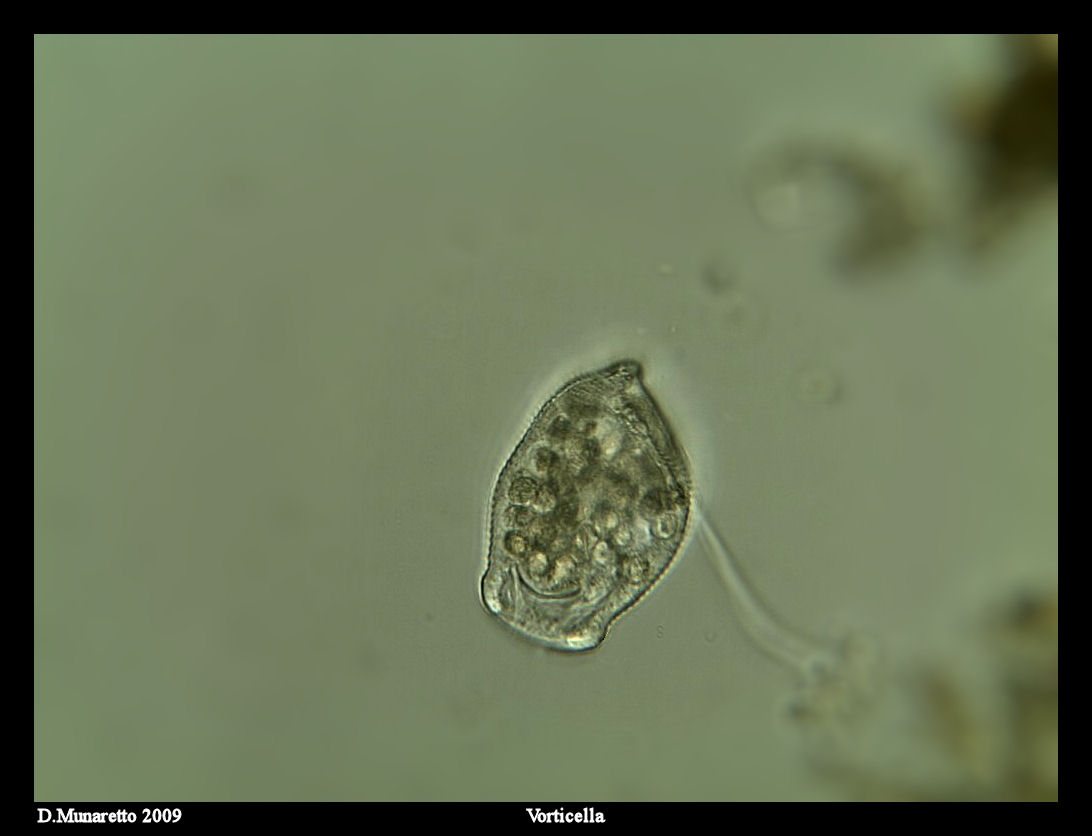 Vorticella
